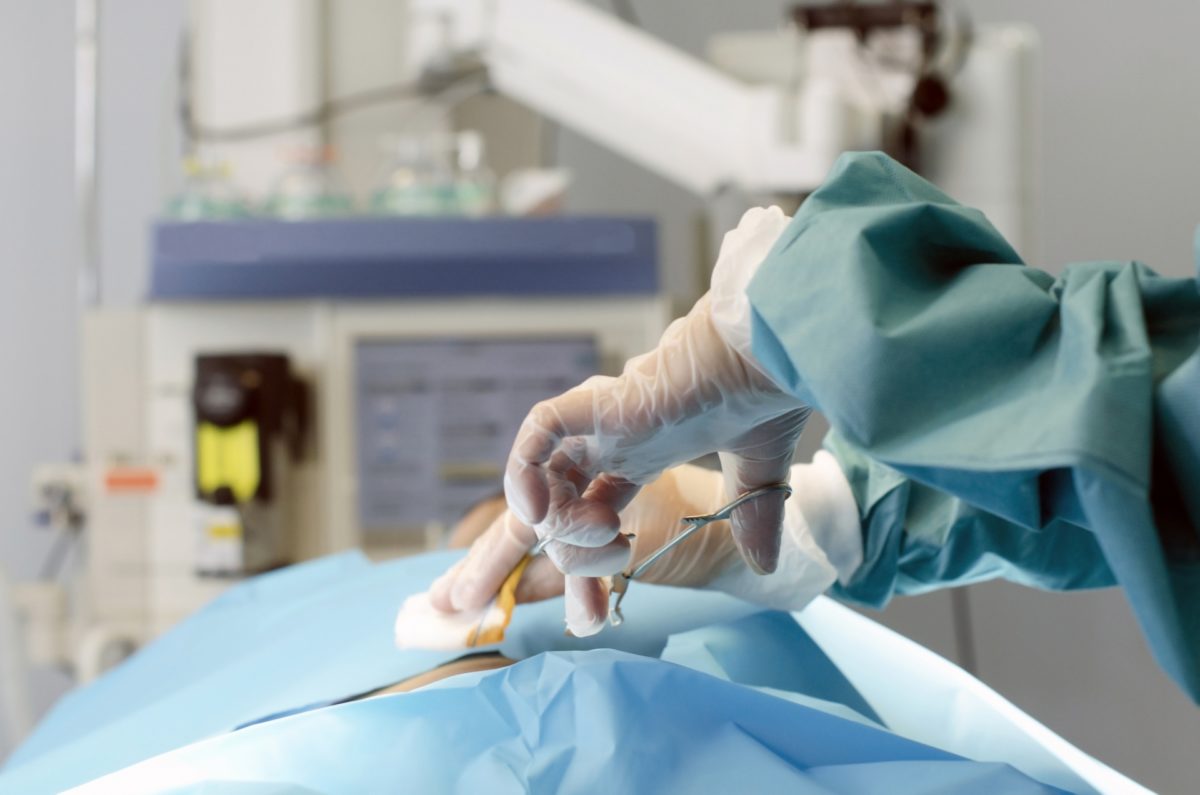 胃がん手術の生存率